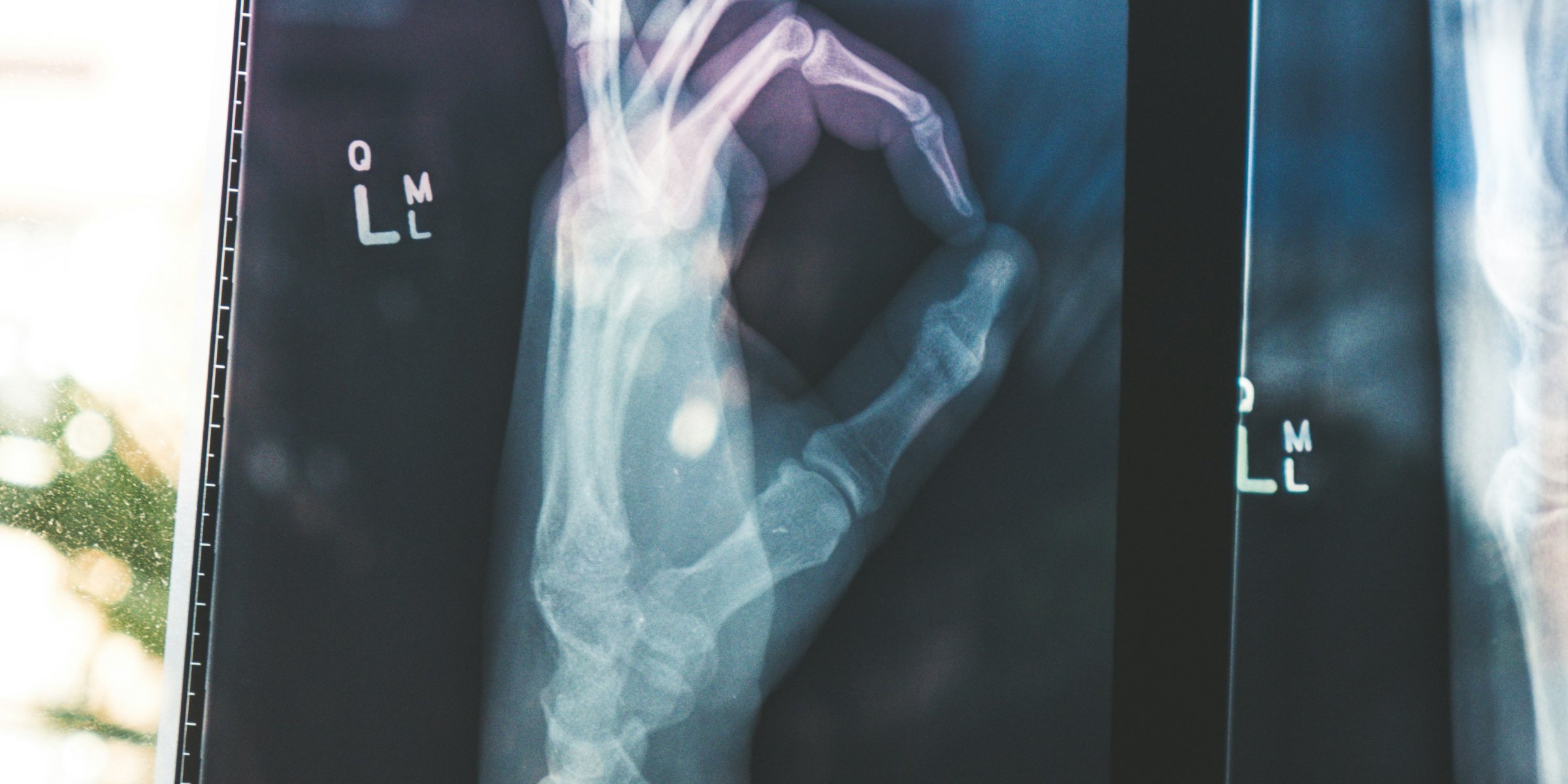 Des quotas de soignants par malade : le rêve américain des infirmières françaises